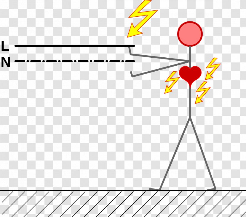 Electrical Injury Electric Current Diagram Clip Art - Yellow - Accident Transparent PNG
