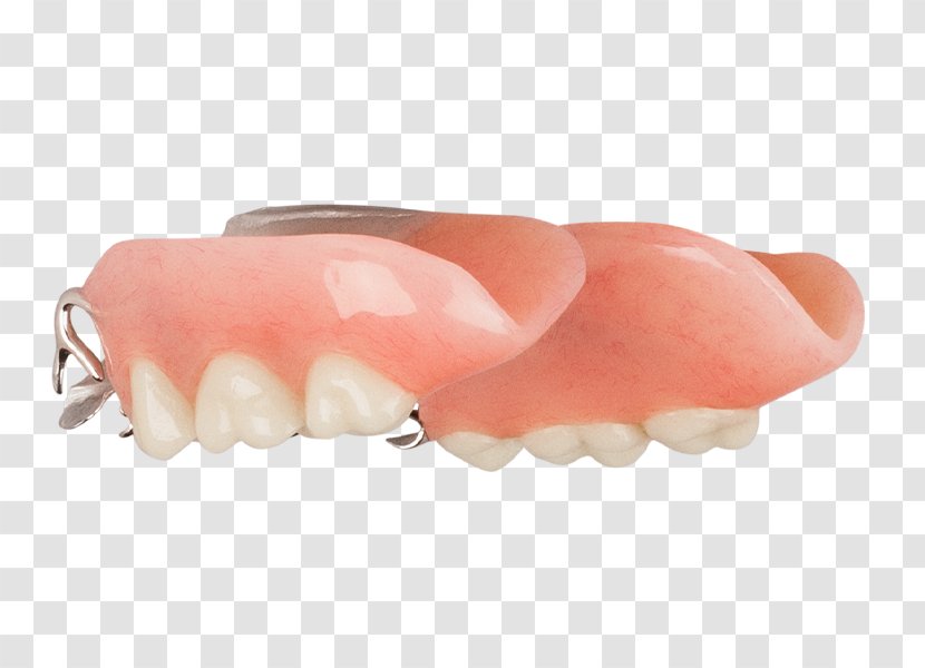 Tooth Removable Partial Denture Dentures Dentistry Aspen Dental Transparent PNG