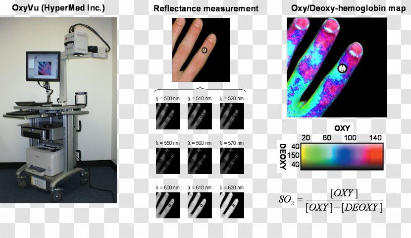 Journal Of Biomedical Optics Hyperspectral Imaging Engineering Diabetic Foot Transparent PNG