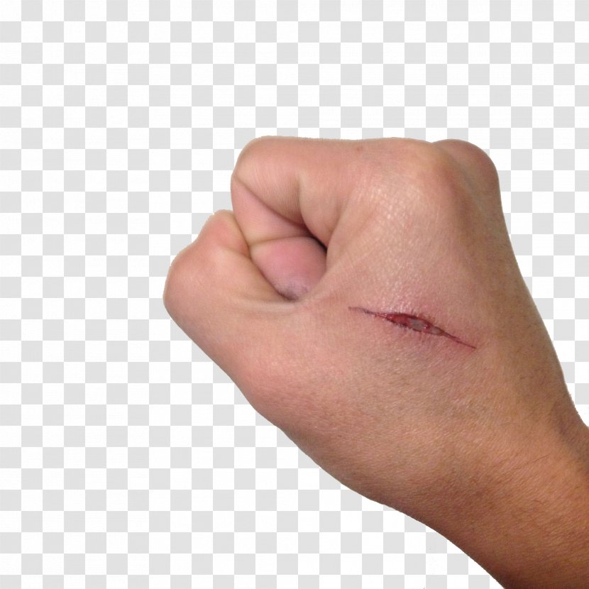 Hand Thumb Scar - Cheek - The Hands Of Knife Marks Transparent PNG