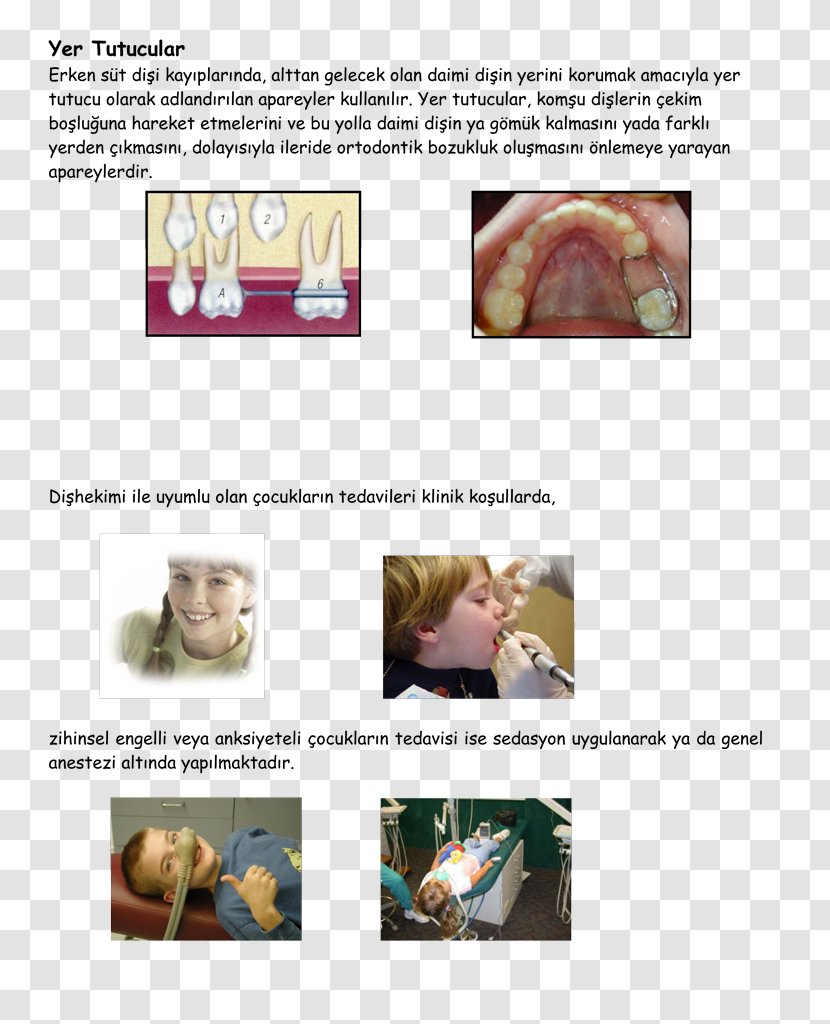 Nitrous Oxide Sedation Organism - Jaw - Dali Transparent PNG