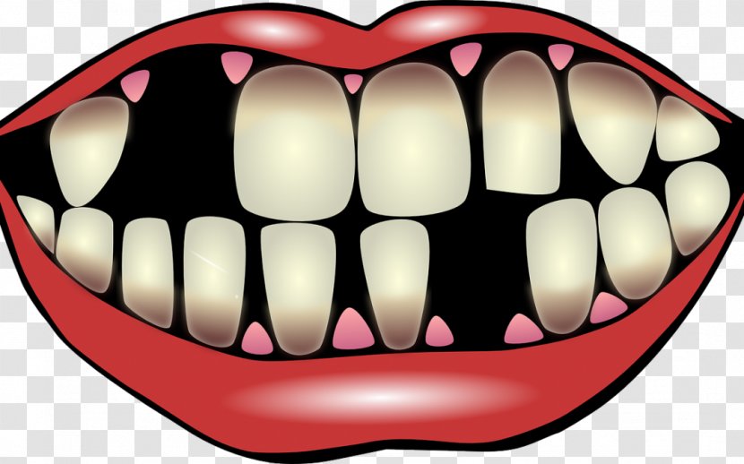 Dental Implant Dentistry Tooth - Cartoon - Teeth Care Transparent PNG
