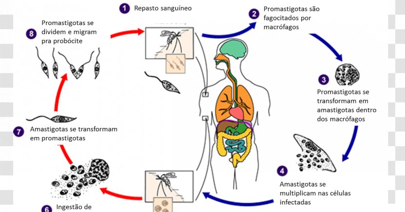 Visceral Leishmaniasis Amastigote Sandfly Drain Fly - Tree Transparent PNG