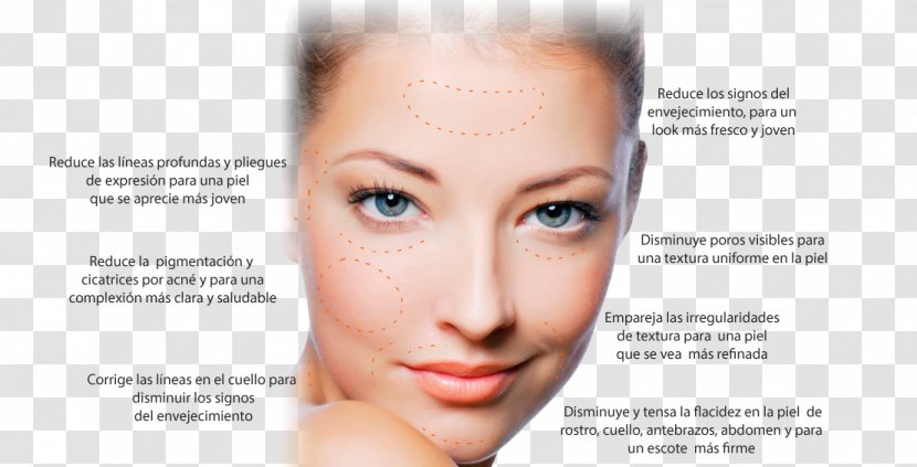 Facial Face Wrinkle Skin Photorejuvenation - Cheek Transparent PNG