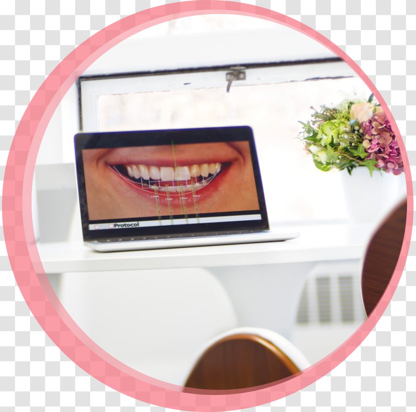 Maria Cardenas, DMD Dentures Dentistry Removable Partial Denture Human Tooth - Massachusetts - Dental Smile Transparent PNG