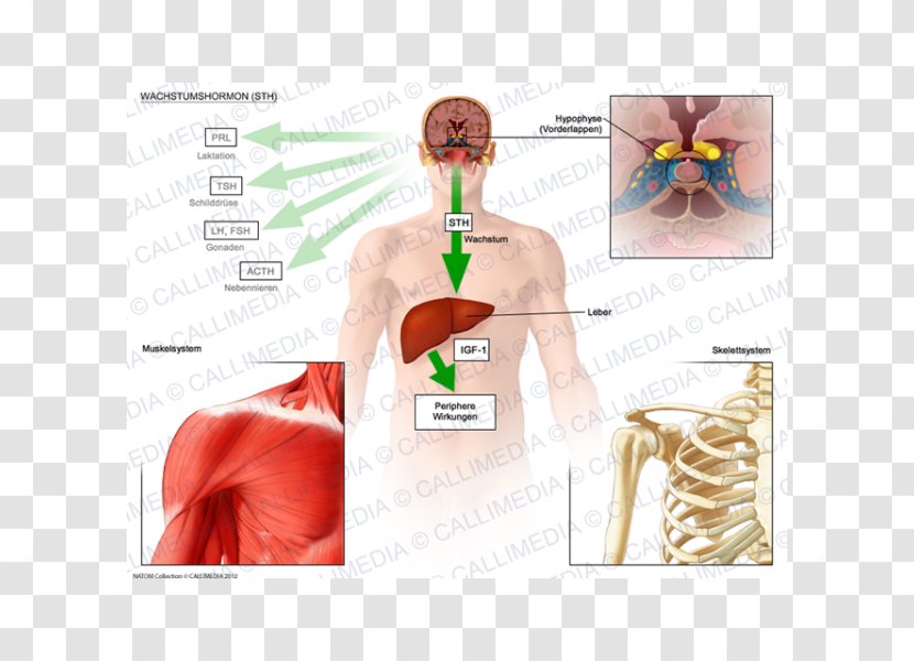 Growth Hormone Pituitary Gland Adrenocorticotropic Development Of The Human Body - Tree - Acromegalia Transparent PNG