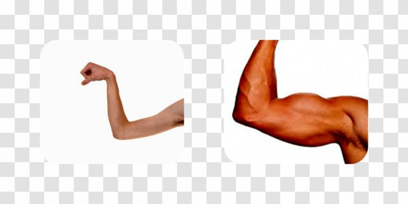 Muscle Weakness Arm Human Body - Cartoon Transparent PNG