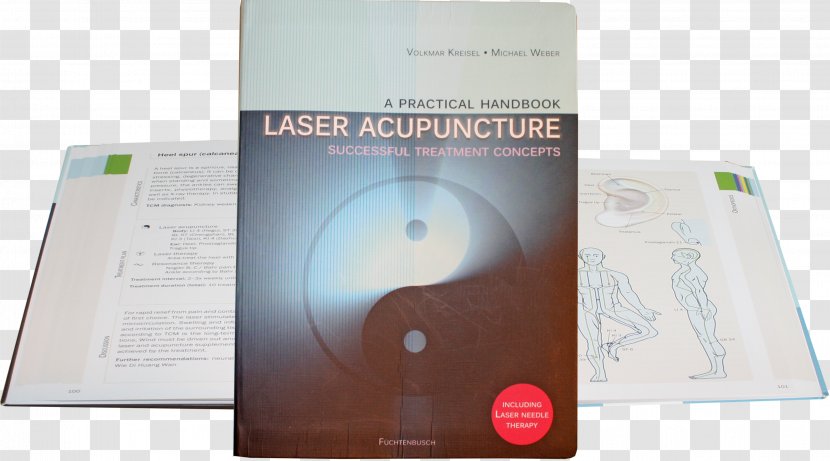 Electronic Filter Design Handbook, Fourth Edition Acupuncture Low-level Laser Therapy - Light - Treatment Transparent PNG