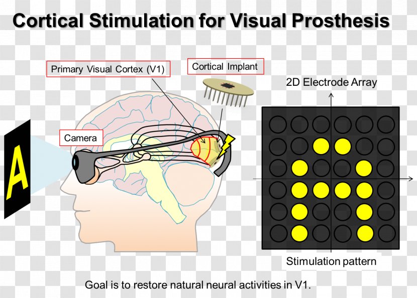 Visual Prosthesis Implant Microcoil Technology - Cartoon - Lee Seung Gi Transparent PNG