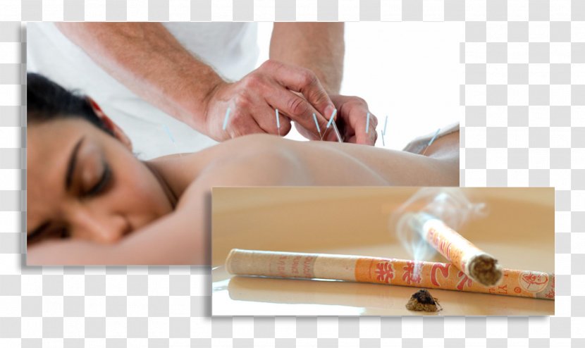 Massage Alternative Health Services Acupuncture North Dakota - Therapy - Acupuntura Transparent PNG