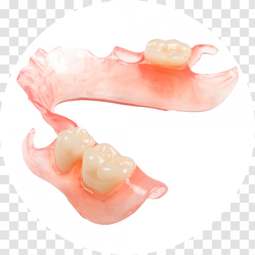 Dentures Dental Laboratory Dentistry Prosthesis - Jaw - Spoof Of Transparent PNG
