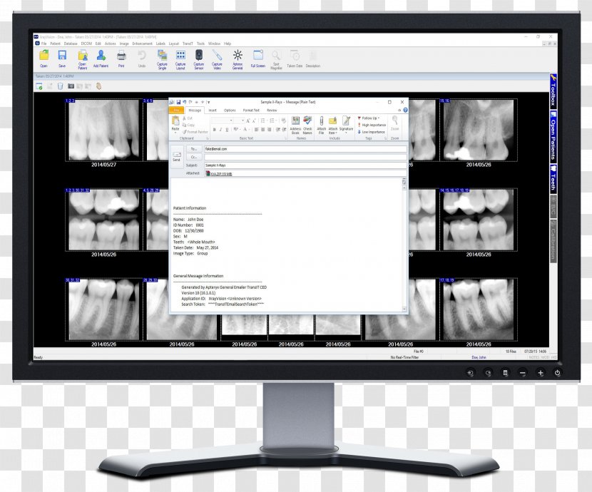 X-ray Vision Computer Monitors Software Display Device Dental Radiography - Dentist - Send Email Button Transparent PNG