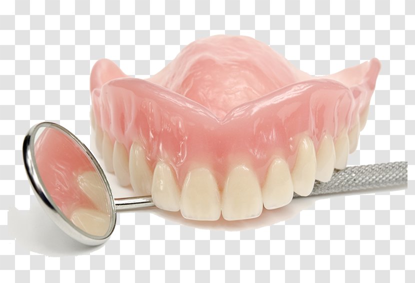 Dentures Prosthodontics Dentistry Tooth - Dental Surgery - Denture Transparent PNG