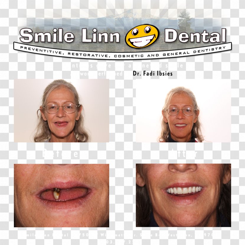 Smile Linn Dental: Ibsies Fadi B DMD Dentistry Lake Oswego Mouth - Laughter - Dental Transparent PNG
