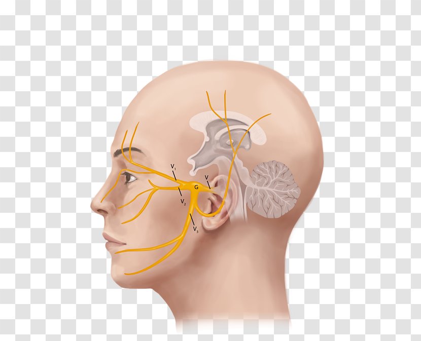 Trigeminal Nerve Neuralgia Headache - Tree - Ear Transparent PNG