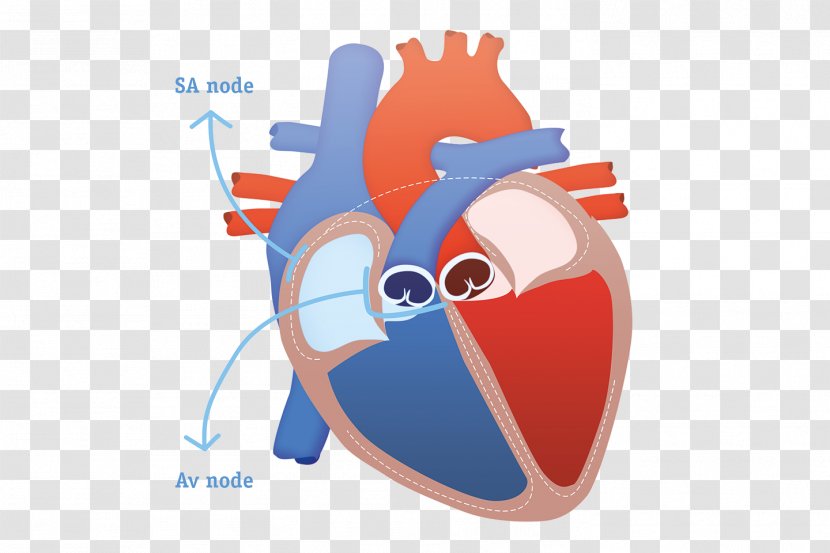 Heart Subcutaneous Implantable Defibrillator Cardiac Arrest Sudden Death Cardioverter-defibrillator - Frame Transparent PNG