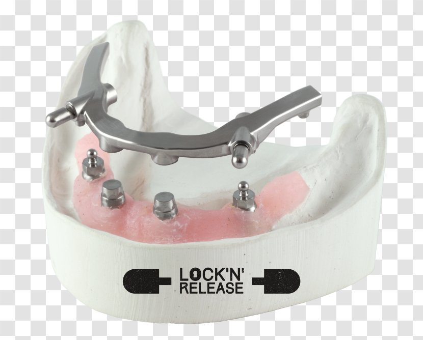 Dental Implant Laboratory Jaw CAD/CAM Dentistry - Cadcam - Parkview Transparent PNG
