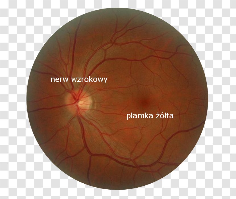 Macula Of Retina Eye Cone Cell Rod - Hypertensive Retinopathy Transparent PNG