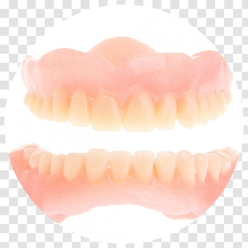 Human Tooth Dentures - Mouth - Cosmetic Dentistry Implants Transparent PNG