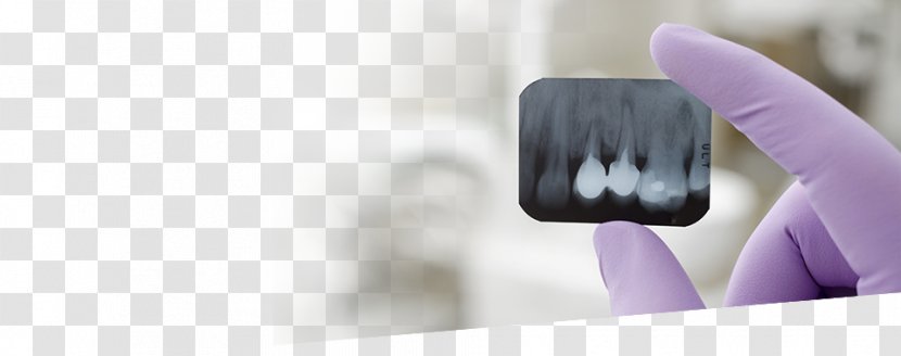 Dentistry Tooth ArseDent Therapy - Cosmetics - Dental Laboratory Transparent PNG