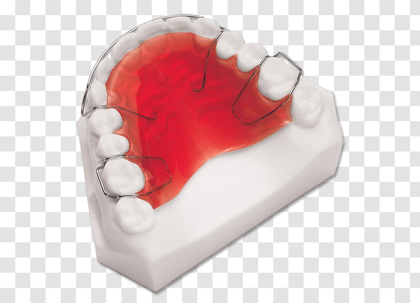 Retainer Orthodontics Dentistry Dental Laboratory - Mouthguard - Tooth Transparent PNG