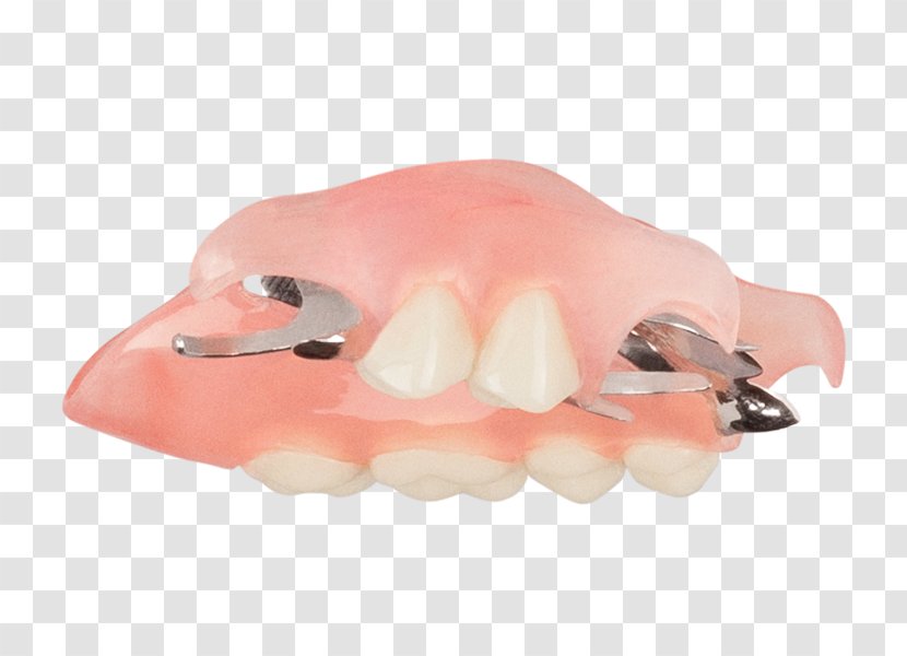 Tooth Dentures Removable Partial Denture Dentistry Crown - Nail - Top Angle Transparent PNG
