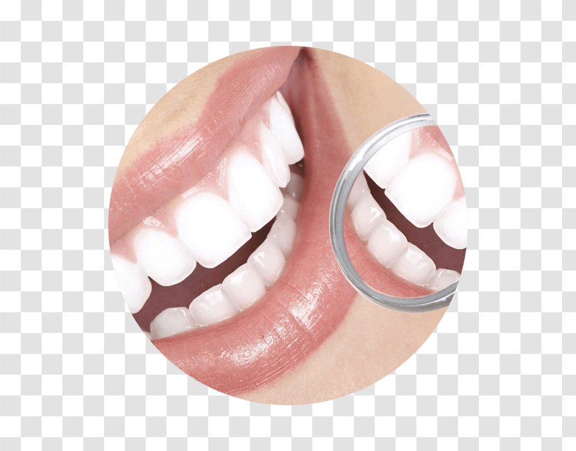 Cosmetic Dentistry Tooth Periodontology - Physician - Restorative Transparent PNG