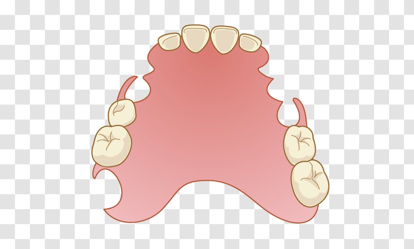 Dentistry Dentures Removable Partial Denture Mouth - Peach - Tooth Transparent PNG
