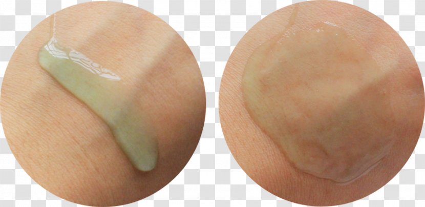 Egg - Skin - Acne Transparent PNG