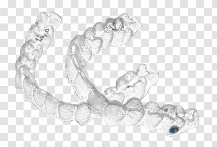 Clear Aligners Orthodontics Dental Braces Dentistry Therapy - Metal Transparent PNG