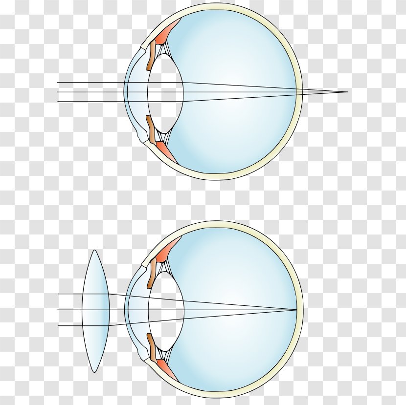 Hypermetropia Near-sightedness Lens Eye Glasses Transparent PNG