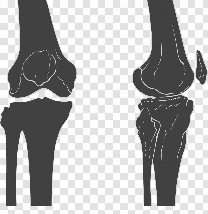 Knee Joint Femur Patella Bone - Watercolor Transparent PNG