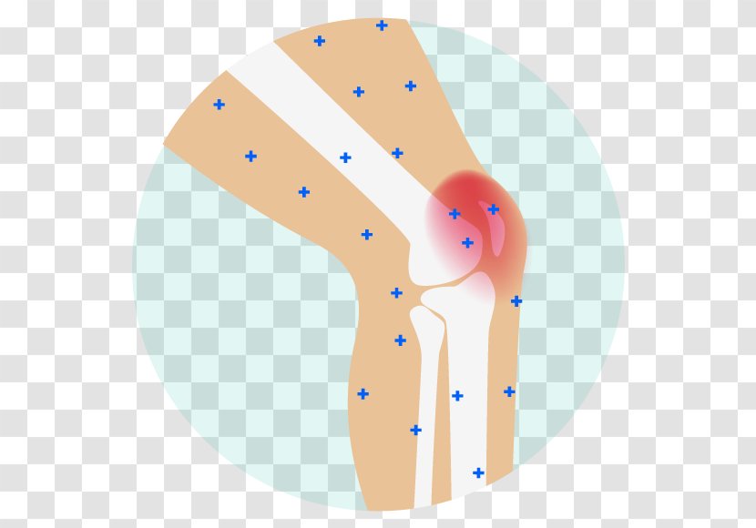 Pain Management Analgesic Joint Arthritis Back - Therapy - Knee Transparent PNG