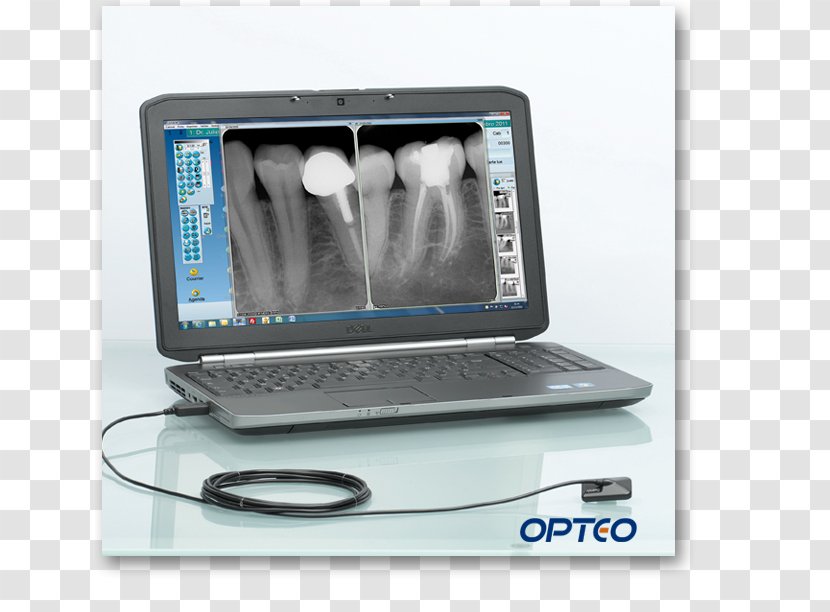 Dentistry Radiology Sensor Digital Radiography Dental - Medical Equipment Transparent PNG