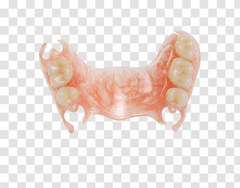 Deflex Tooth Empresa Virodent System - Hand - Dental Implant Transparent PNG