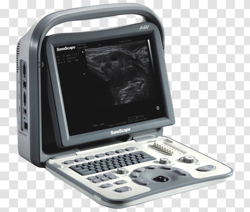 Portable Ultrasound Ultrasonography Doppler Echocardiography Medical Diagnosis - Sonoscape Corp Transparent PNG