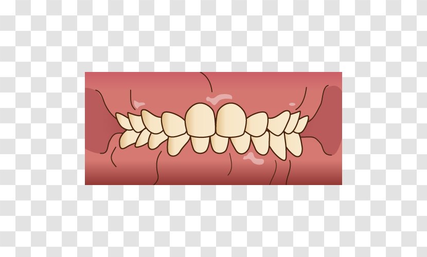 Tooth Dentist 歯科 Prognathism Dental Hygienist - Frame - Kids Transparent PNG