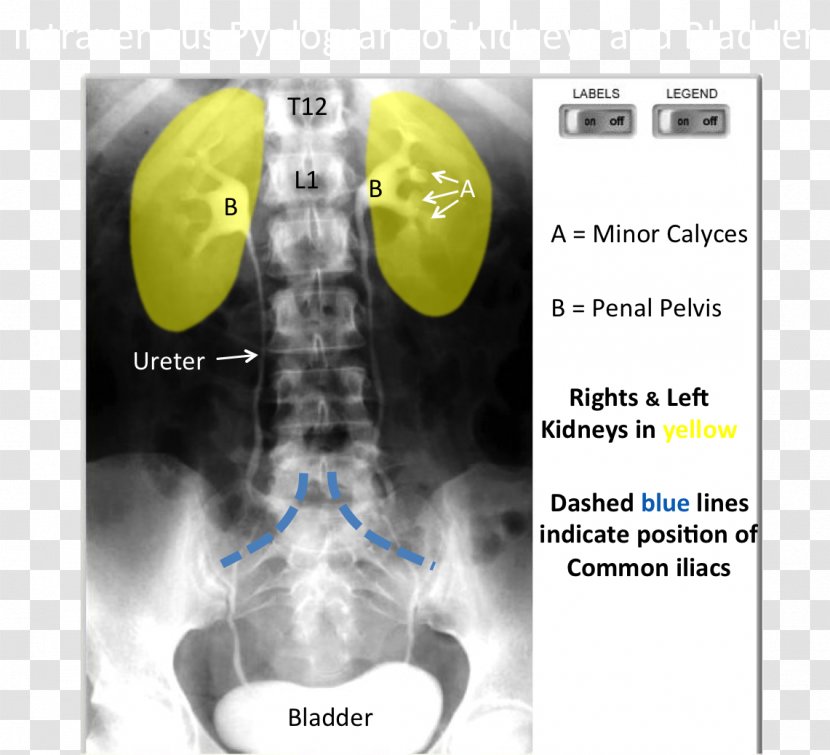 Medical Imaging Radiology X-ray Medicine - X Ray Transparent PNG