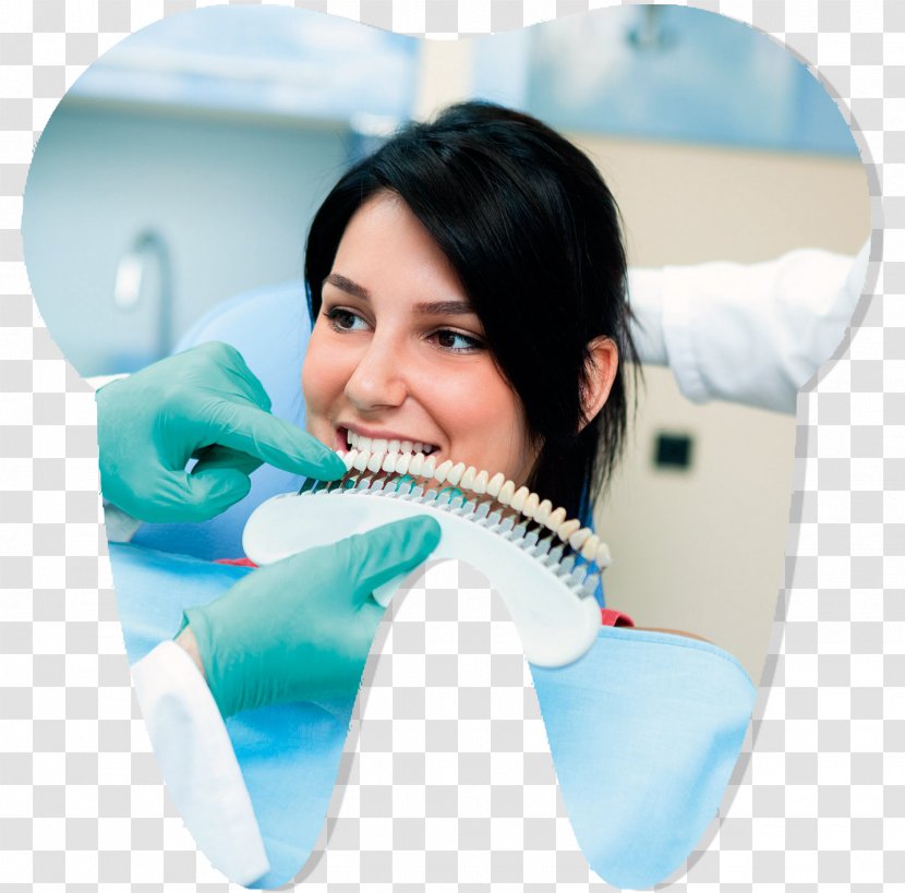 Tooth Whitening Dentistry Veneer - Health Transparent PNG