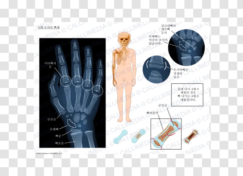 Pediatrics Medicine - Esqueleto Transparent PNG