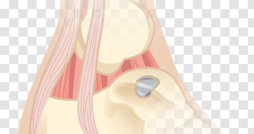 Finger Hip Shoulder - Cartoon - Orthopedic Surgery Transparent PNG