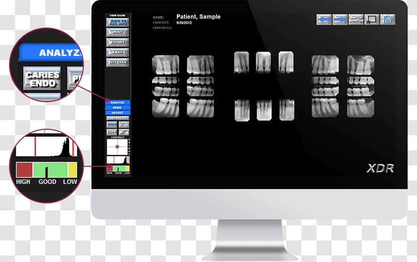 Touchscreen Computer Software Display Device Sensor - Monitors - Orthodontic Correction Transparent PNG
