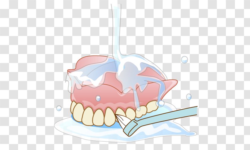 Tooth Dentures Dentist Therapy Removable Partial Denture - Complete - Periodontal Disease Transparent PNG
