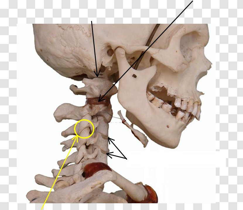 Bone Skeleton Joint Jaw Skull - Ligament Transparent PNG