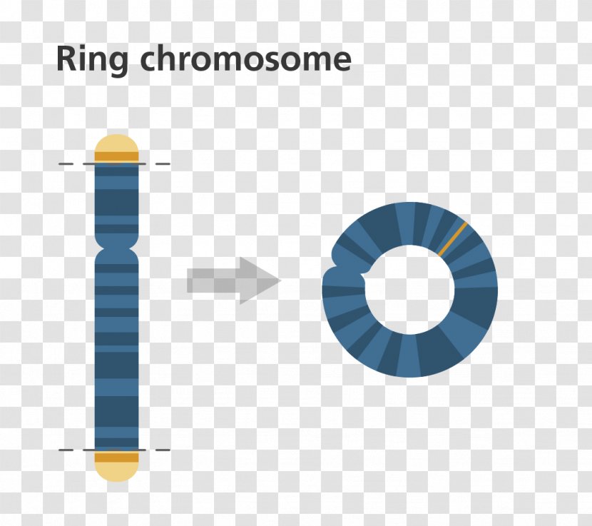 Ring Chromosome 14 Syndrome Abnormality Genetics Transparent PNG