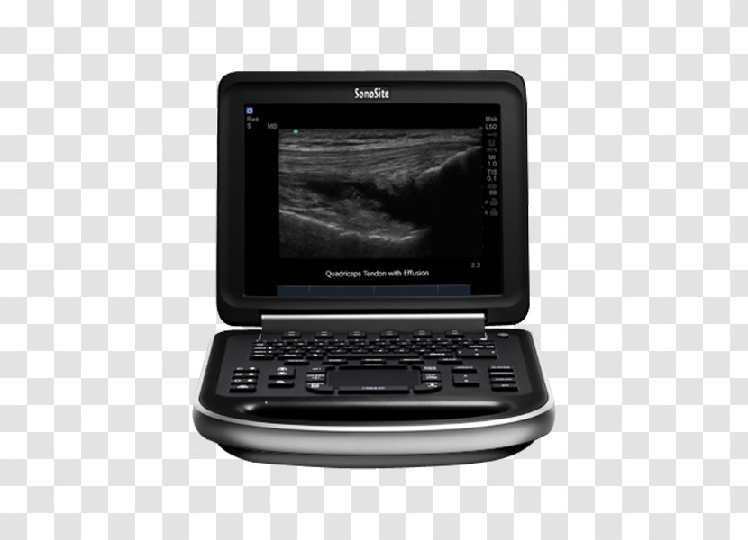 Ultrasonography Ultrasound SonoSite, Inc. Medicine Medical Imaging - System - Machine Transparent PNG