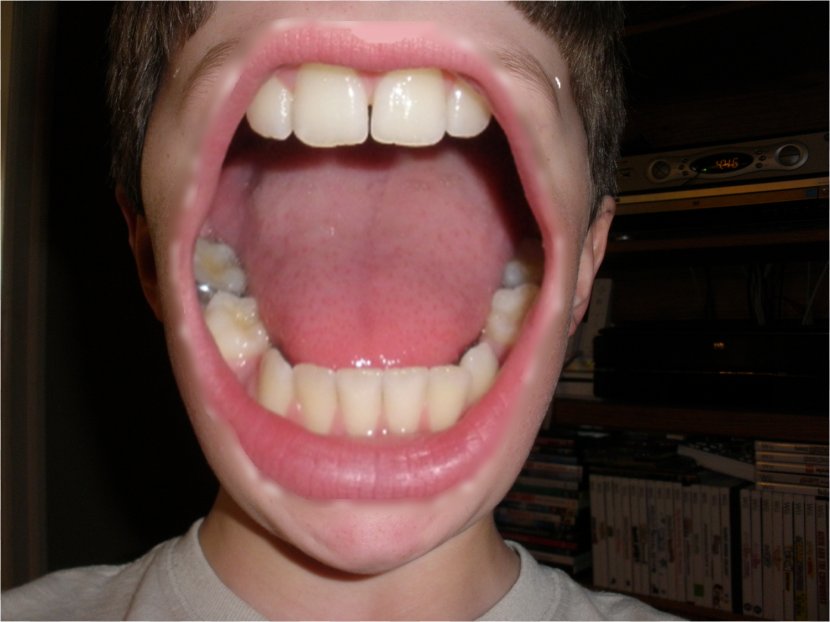 Mouth Smile Sneeze Laughter - Frame Transparent PNG