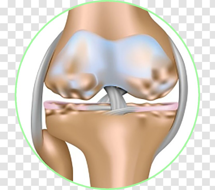 Osteoarthritis Joint Effusion Knee - Cartoon - Khop Transparent PNG