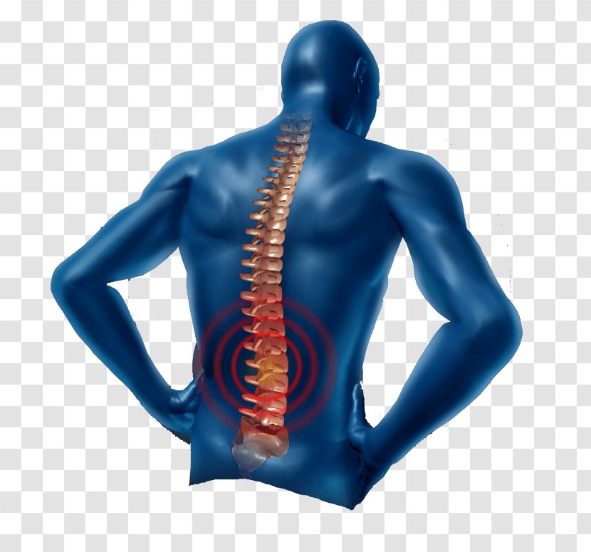 Low Back Pain Neck Physical Therapy Management - Whiplash - Human Transparent PNG