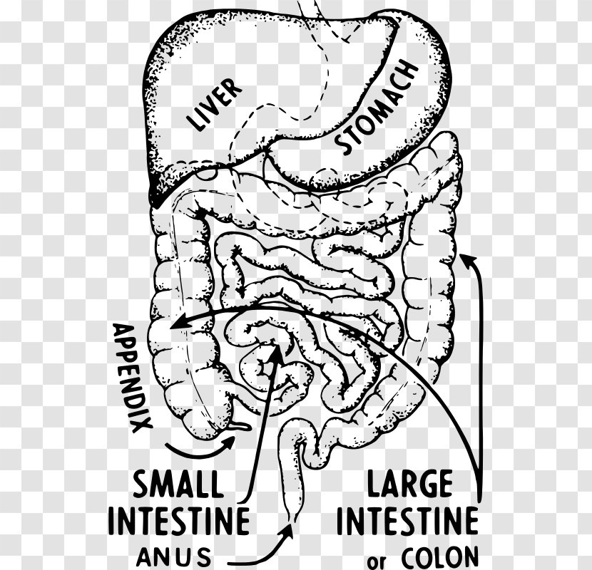 Appendix Appendicitis Large Intestine Symptom Abdominal Pain - Tree Transparent PNG